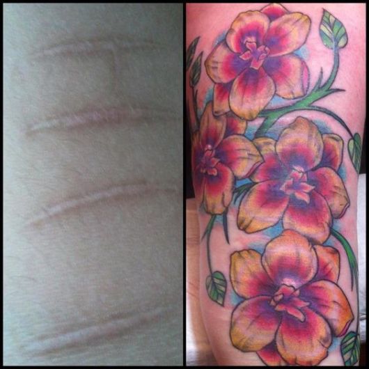 Tatuaje para Cubrir Cicatriz: ¡Consejos y más de 40 ideas!